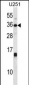 STC1 Antibody (C-term)