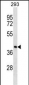 FDPS Antibody (N-term)