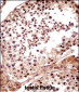 TNKS Antibody (N-term)