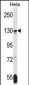 TNKS Antibody (N-term)