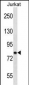 CACNB2 Antibody (Center)