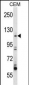 ARHGEF1 Antibody (N-term)