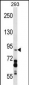 DDX20 Antibody (C-term)