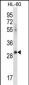 ICOSLG Antibody (C-term)