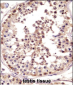 TSPY Antibody (C-term)