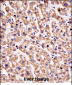 HYAL1 Antibody (C-term)