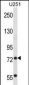 TRIM2 Antibody (C-term)