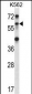 TRIM27 Antibody (C-term)
