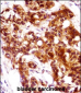 KRT7 Antibody (N-term)