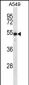 KRT7 Antibody (N-term)