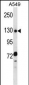 RBM5 Antibody (N-term)