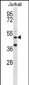 RBM22 Antibody (Center)