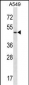 UTS2R Antibody (Center)