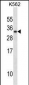 PRL Antibody (C-term)