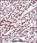 MOV10 Antibody (N-term)