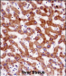 IHH Antibody (N-term)