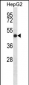 IHH Antibody (N-term)