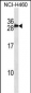 S100B/S-100 Antibody (Center)