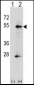 ALPP Antibody (N-term)