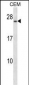 CD79A Antibody (Center)