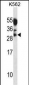 MYOG Antibody (Center)