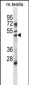 HDAC11 Antibody (Center)