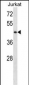 STK33 Antibody (N-term)