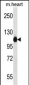 ACTN2 Antibody (C-term)