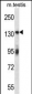 Mouse Erbb2 Antibody (Center)