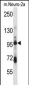 SMURF1 Antibody (Center)