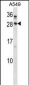 BARX1 Antibody (C-term)