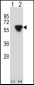 PRKAR2B Antibody (Center)