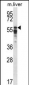 PPP2R5A Antibody (C-term)