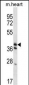 KLF2 Antibody (N-term)