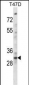 KLF2 Antibody (N-term)