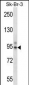 TBX3 Antibody (Center)