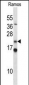 COPS8 Antibody (N-term)