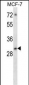 ATF5 Antibody (C-term)