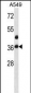 LASP1 Antibody (Center)