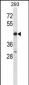 POU4F2 Antibody (C-term)