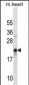 CREG1 Antibody (N-term)