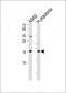 NME1 Antibody (Center)