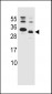 KRAS2 Antibody (C-term)