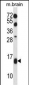 TCEB2 Antibody (N-term)