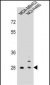 FOLR2 Antibody (N-term)