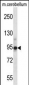 CHRD Antibody (Center)