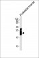 TNNI2 Antibody (N-term)