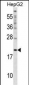 CYGB Antibody (N-term)