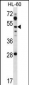 ZIC1 Antibody (N-term)