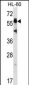 HSF4 Antibody (N-term)